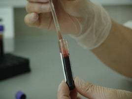 Análisis de sangre en un laboratorio.