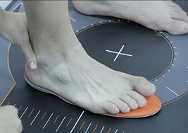 Los callos pueden aparecer en la planta del pie, entre los dedos o a los lados.