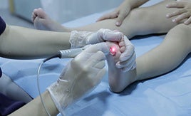 Los podólogos recomiendan realizar revisiones semestrales o anuales de pies para niños con diabetes.