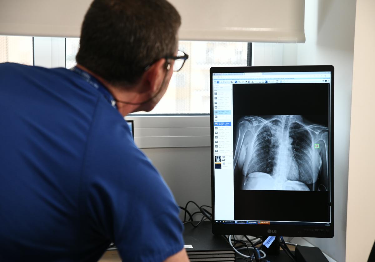 Los hospitales de Alicante aplicarán inteligencia artificial para mejorar las radiografías de tórax y hueso