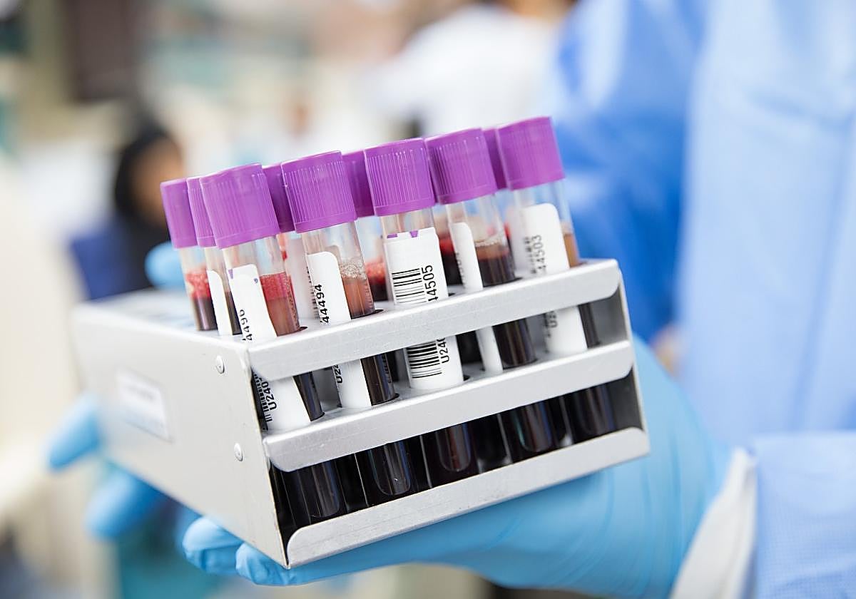 Blood samples in a laboratory.